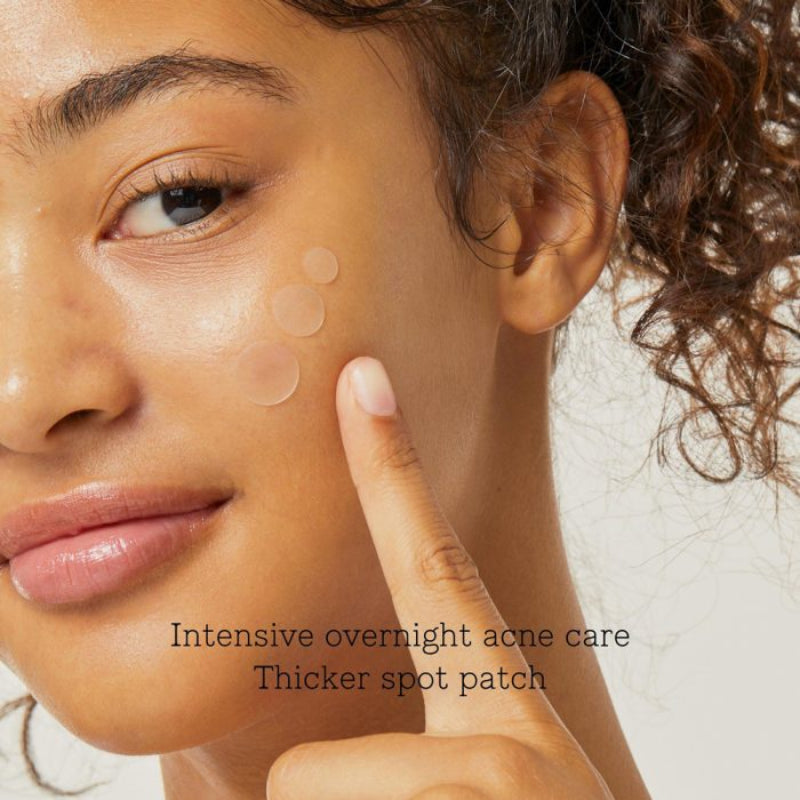 Woman applying a spot patch to her face with text about intensive overnight acne care.