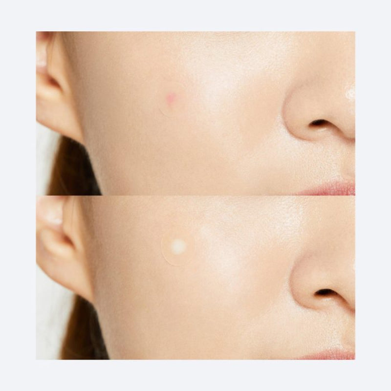 Close-up of a person's face with a focus on the skin texture and pores.